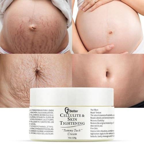 7better LLC Crema para eliminar estrías y cicatrices durante el embarazo: repara, tonifica el abdomen y elimina suavemente las estrías, cuidado de la piel
