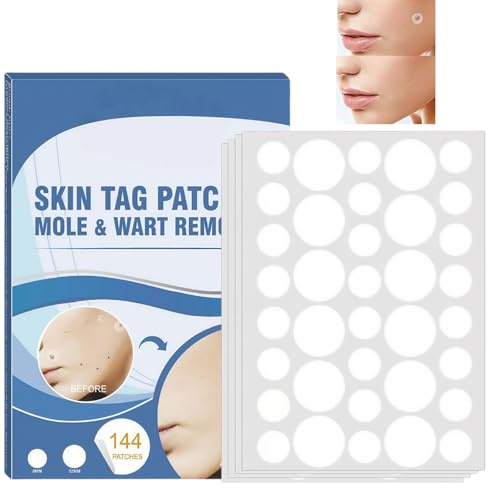 144Pcs Wart Removal Patches,Remover Patches Mole Wart Removing Sticker,Tags and Mole Remover,Mole Remover Treatment Patches,Wart Remover for Face,Effectively Remove,Suitable for All Whole-Body Use