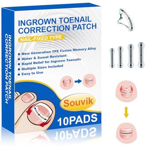 Souvik Juego de corrección de uñas encarnadas, corrector de uñas, 10 unidades, para hombres y mujeres, corrector de uñas, para uso doméstico, 17/18/19/20 mm