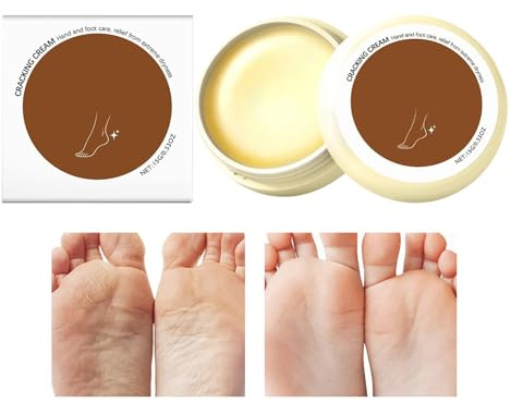Crème Mains Sèches - Baume Anti-Fissures Pour Les Pieds - Crème Pour Pieds Secs - Pour Les Peaux Mortes Femmes Hommes Personnes Âgées Sportifs Orteils Coudes Automne
