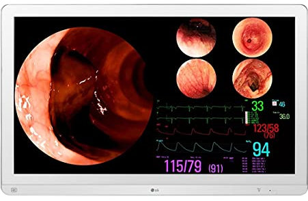 LG Ultra HD Display, White, 80 cm