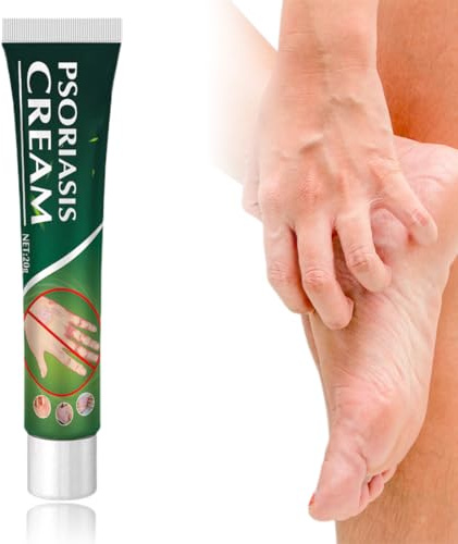 AYVROUP Crema per la tigna,Crema Lenitiva Antiprurito,Cremas per Il Corpo per Sollievo dal rossore e dal prurito, Sollievo per Il prurito della Pelle, Mani Gambe Braccia(20g)