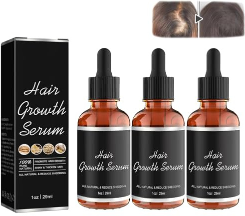 Noor hårtillväxt serum afrikanska oliver 3 st, Noor hårtillväxtserum, anti-håravfall ger näring åt torrt skadat hår