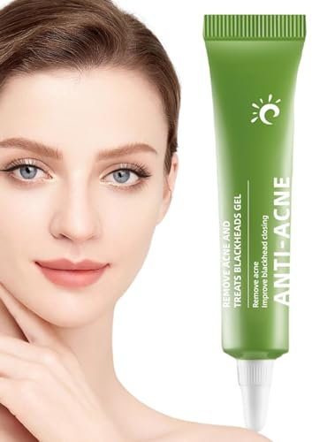 Crema per ridurre i brufoli, Crema idratante per i brufoli, rimozione di imperfezioni, crema anti-cicatrici, sollievo dal rossore, crema schiarente per la pelle, trattamenti viso Soydan