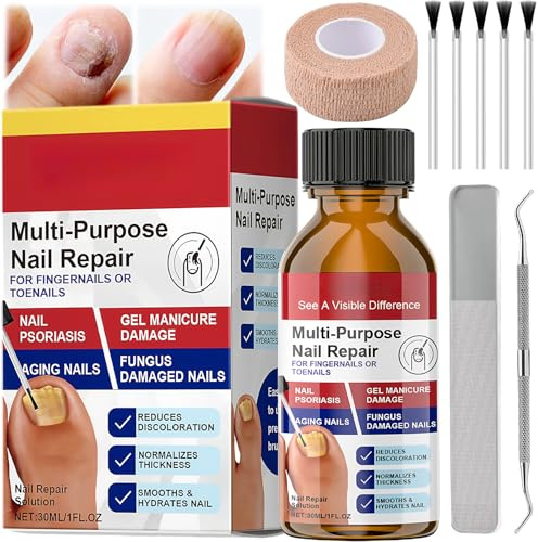 Extra Strong Fungal Nail Treatment for Toenails & Fingernails - Powerful Nail Fungus Treatment for Toenail, Protects Thick, Broken And Discolored Nail. 30ml Pack: Toenail File, Spoon, Brush Head, Tape