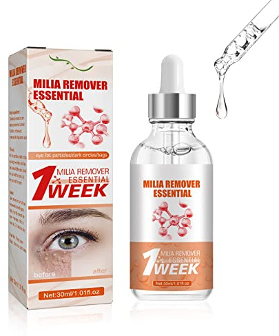 Speedy Milia Remover,Siero Purificante per Macchie Cutanee bio,Trattamento per Macchie di Milia per gli Occhi,Rimuove le Particelle Grasse Sotto gli Occhi,Riduce le Linee Sottili