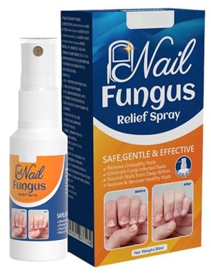 Fungal Nail Treatment Spray,Anti-Fungal Formula for Nail Repair,Anti-Fungal Nail Repair Effective for Broken and Discolored Nail, Promotes Healthy Nail Growth, Easy Spray Design
