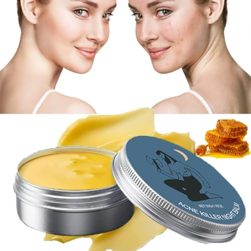 Norse Organics Baume anti-acné, baume anti-acné Norse Organics, tueur d'acné et de rougeurs, crème éclaircissante pour homme et femme, soin de la peau ultra performant