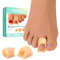 Welnove Hammertoe Corrector - 6 Pack Toe Splints - Soft Gel Toe Straighteners - Realign Bent, Curled, Crooked, Claw, Hammer Toes - Toe Corrector for Men and Women, Large(Beige)