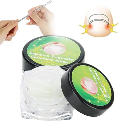 Professionelle Nagelkorrektur Aufkleber – Zehennagelpflege Pediküre & eingewachsene eingewachsene Zehennägel für Sets & Kits Zehennagel Werkzeug(24Pcs)