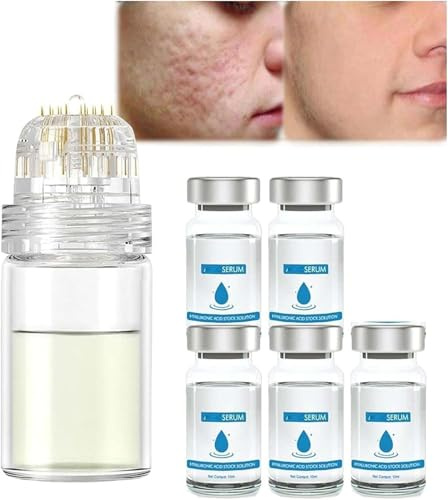 Micro Infusion System für Lippen, Micro System für Gesicht, Gesichtssystem mit Serum, Pockmarksheal Hyaluronsäure Microdart Roller, Smooth Skin Gesichtsserum für alle Hauttypen (5Pcs)