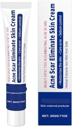 Kräuter-Akne-Clearing-Creme – Ölkontrolle, Sanfte Porenreinigung, Feuchtigkeitsspendende Und Beruhigende Gesichtscreme For Reinere Haut(2PCs)