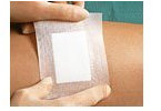CURAPOR Wundverband steril chirurgisch 10x20 cm 50 St