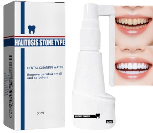 Dental Calculus Cleaning Spray, A Long-Lasting and Refreshing Tartar Remover for Teeth —— A Plaque Remover for Teeth, A Teeth Whitening Spray, Anti-halitosis Spray (30ml)