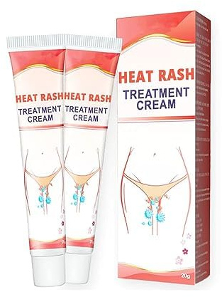20g Heat Rash Treatment Cream,Heat Rash Care Cream,Heat Rash Cream,Fast Relief from Sweat Rash,Anti-Itch Soothe Eczema Ointment (2 pcs)