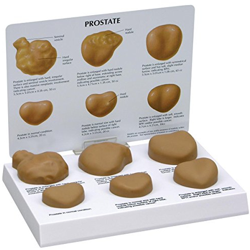 3B Scientific GPI Anatomicals Prostatamodell