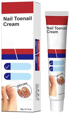 Toe Nail Cream - Strong Formula for Stubborn Toenail - Natural Safe Ingredients for Gentle Nail Care - Deep Nourishing for Thick Discolored Nails - Long-Lasting Protection Against