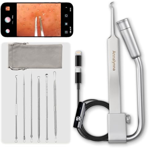 Luma 1 Visual Blackhead Remover Tweezers with Camera - Pimple Popper Tool with Camera 20x Magnification, 1080P, 8 LED Lights, with Blackhead Remover Pimple Popper Tool Kit (6 Piece Kit)