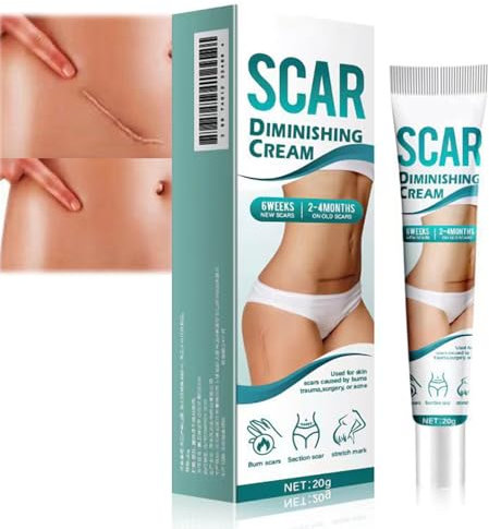 Scar Cream for Face & Body - Assists in Enhancing The Look of Stretch Marks, C - Section Scars, Surgical Scars - Suited for Old & New Scars - Facilitates Skin Restoration