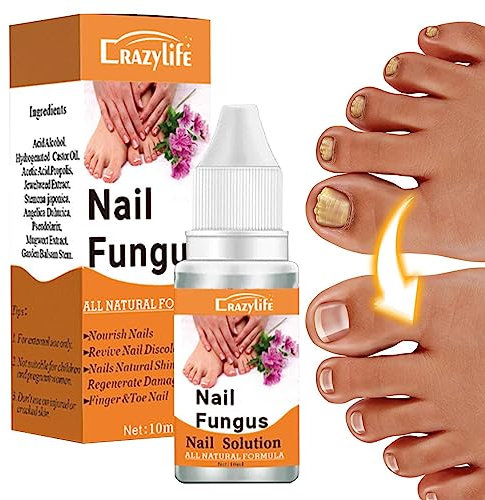 Qiongni - Soluzione naturale per unghie dei piedi, cura extra forte, 10 ml, soluzione per la cura delle unghie, riparazione per unghie danneggiate, liquido rigenerante unghie scolorite