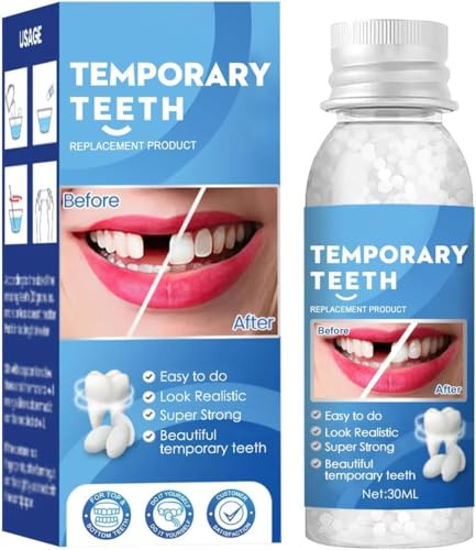 Temporary Tooth Filling, Tooth Filling Repair Kit, Moldable False Teeth Beads, Temporary Filling Kit for Teeth, Dental Repair Set for Missing Broken Teeth Restoration & Quick Oral Gap Fixing
