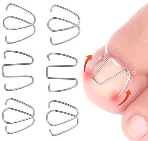Correttore dell'unghia incarnita, fissatore del filo dell'alluce, kit di strumenti per pedicure Correttore del bunion per la cura del piede per il restauro dell'unghia