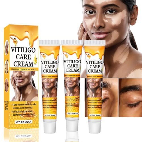 Grgowe Crema Per Il Trattamento Della Vitiligine - 3pcs Unguento Per La Cura Delle Macchie Bianche Sulla Pelle