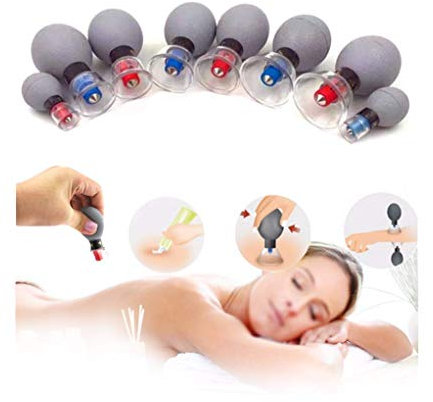 SXTYFBB Vakuum-Schröpfset, TCM-Magnetfeldtherapie-Akupressur-Saugnäpfe, Massage-Muskelgelenk-Schmerzlinderung, Akupunktur-Moxibustion-Massagegläser, 8-teilig