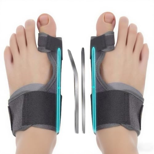XFSRG 1 Paio Tutore Alluce Valgo Regolabile Tutore Alluce Valgo Correttore Divaricatore Alluce Valgo Separatore di Dita per Donna e Uomo Proteggi Dita Piedi, Sollievo Dal Dolore