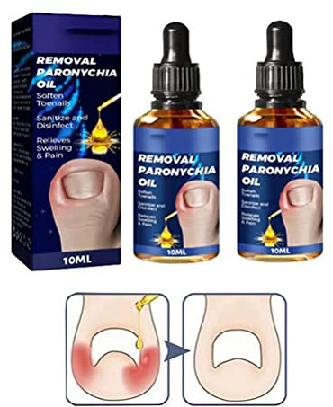 LWuuywa German Toenailplus Anti Paronychia Relief Oil, 10ML Korrektur Behandlung Öl, Nagelpflege pflegend Einwachsen Zehennagel Anti Paronychia Hilfe Öl, eingewachsene Zehennagel Tropfen