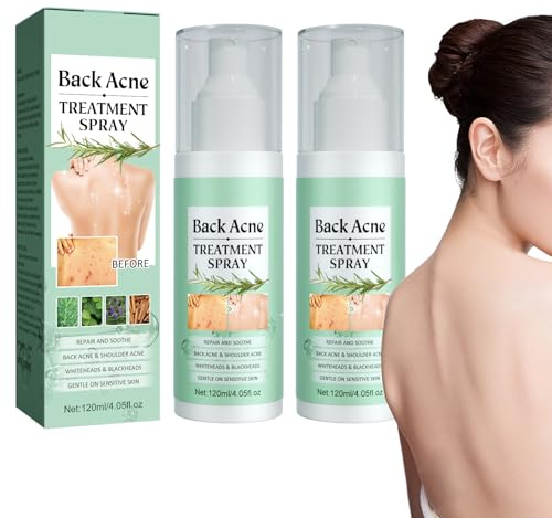 Pemarlis 2pcs*120ml Back Acne Spray, Exfoliante de Espalda Limpieza Profunda para Cuerpo,Aclarar marcas de acné,Bruma para el cuidado de la piel,Suave con la Piel