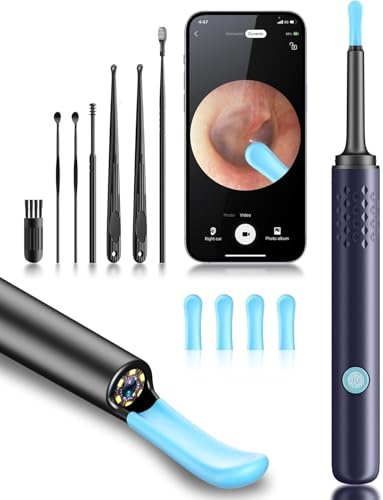 Verktyg för borttagning av öronvax – öronrengörare med kamera, 1080P otoskop, öronrengöringsverktyg med 6 öronsked, öronkamera för iPhone och Android-telefoner – blå
