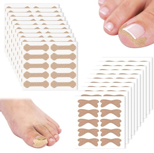 UIEXAY 200 Pezzi Correttore Per Unghie Incarnite, Unghia Incarnita Alluce, Unghie Incarnite Piedi, Cerotti Per Unghie(2 Stili)