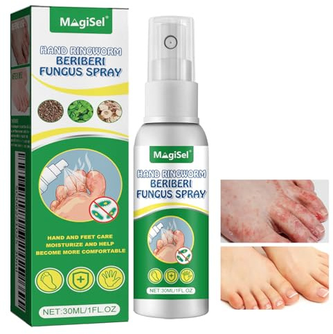 30ml Athletes Foot Odour Spray, Foot Peeling for Dead Skin and Calluses, Relieve Itchy Feet, Cracked Dead Skin Care for Remove Odor