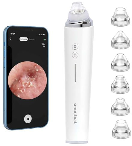 Smartbud Blackhead Pro - Blackhead Remover Tool, Pore Vacuum with 1080p HD Camera, Facial Pore Cleanser, Pimple Acne Extractor Kit Suction Tool with 6 Suction Heads, Black Head Remover for Face