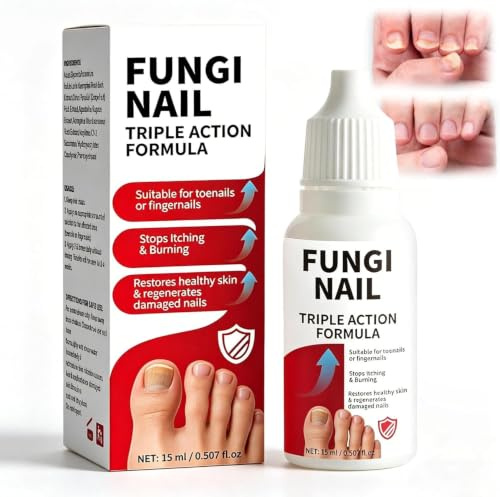 Potente soluzione per il trattamento dell'onicomicosi, migliora le unghie ispessite, ingiallite e fragili; rende le unghie dei piedi più sane e trasparenti. (15 ml)