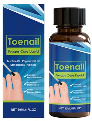 Niesel Nagelpflege für beschädigte Nägel, 30 ml, pflegendes und stärkendes Produkt, beschädigte Nagelreparaturlösung, für Männer, Frauen, Freunde, Zuhause, Reisen, Salon, Maniküre, tägliche