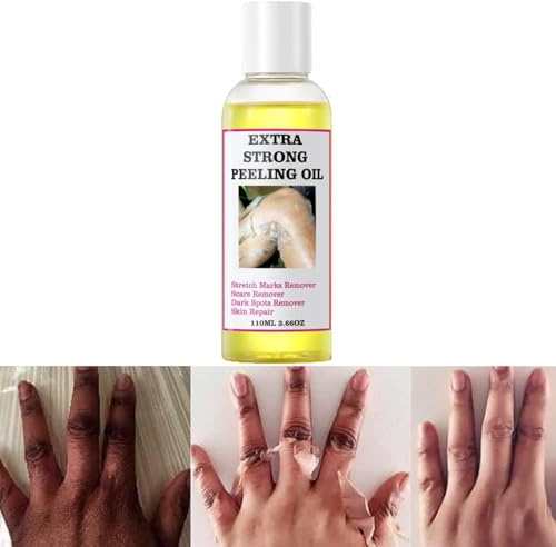 Generic Extra Strong Yellow Peeling Oil for Dark Skin - Exfoliating Solution for Body, Hand, Feet and Face - All Skin Types (110ML/3.88 Fl Oz)