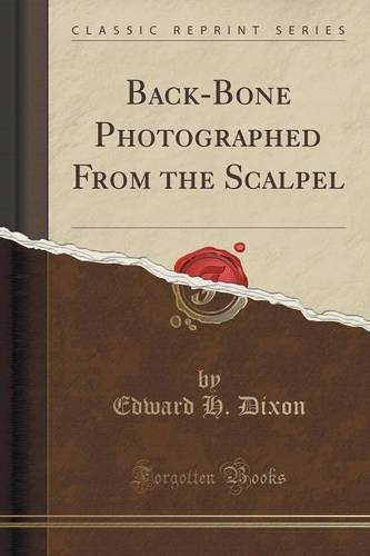 Back-Bone Photographed From the Scalpel (Classic Reprint) by Edward H. Dixon (2015-11-26)