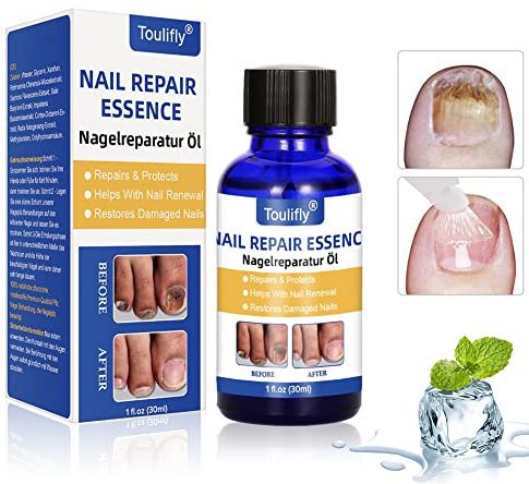 Nagelpflege und Behandlung, Nagelpflege für gesunde Fuß und Hand, Nagelpflegeöl,Nagelpflege pflegend