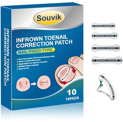 Souvik Set di 10 attrezzi per correggere le unghie incarnite, fermaglio correzione delle unghie dei piedi, piegatura a 180° e memory Alloy Rebound, per uso domestico - Uomini e donne