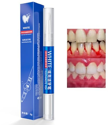 Teeth Whitening Pen, Instant Brightening Teeth Whitening Gel – No Sensitivity Teeth Whitening Kit, Effective & Enamel Safe Teeth Whitener, Fast-Acting Stain Remover for Teeth with Natural Ingredients