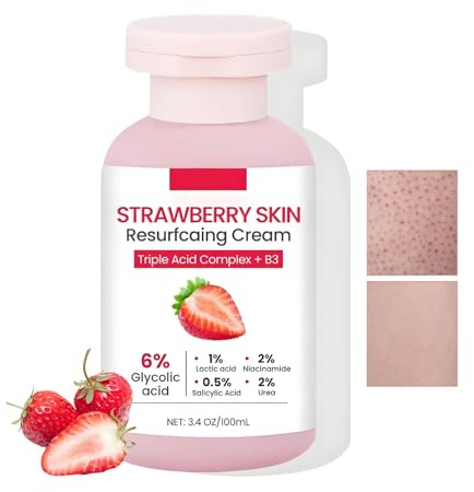 Crema trattante per la pelle alla fragola, crema rigenerante alla fragola, lozione avanzata per il trattamento delle gambe con triplo complesso acido per cheratosi pilare e gambe ruvide