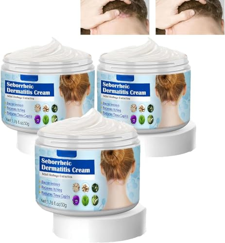 EXQST 50 g de crème pour la dermatite séborrhéique, pour Le Psoriasis, à Action Rapide et apaisante, crème séborrhéique pour Le Cuir chevelu, crème Anti-démangeaisons pour soulager Le Cuir chevelu