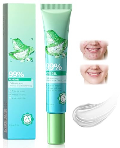 25g Anti Brufolo Gel,Crema Anti-Acne,Gel Anti-Brufolo,Crema Brufoli Viso, Riduce Brufoli,Adatto alla Maggior Parte Delle Persone,Migliora l’Aspetto della Pelle