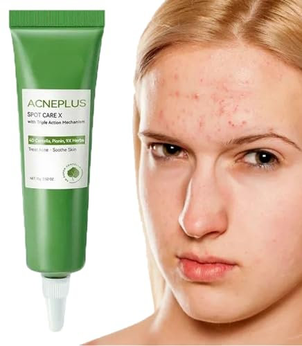 Gentle Anti Acne Face Cream - Plant Extract Moisturiser for Acne Prone Skin, Fades Marks & Calms Redness