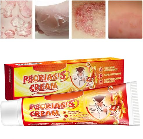Anti-Itch & Soothing Skin Cream – Fast Relief for Irritation, Gentle on Sensitive Skin, Helps with Fungal Issues Like Ringworm, 60g Tube (A-1)