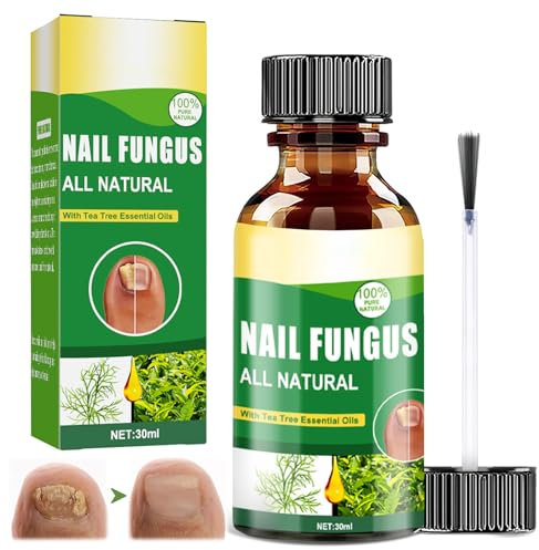 30ML Fußnägel pflegend,Nagelpflege,Schutz & Stärkung brüchiger Nägel,Spendet Feuchtigkeit trockener Nagelhaut,Splitternde & Weiche Nägel Starke Nägel Einfach & Schnell