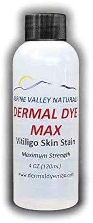 Waterproof Vitiligo treatment skin dye for darkening un-pigmented skin patches. Long lasting alternative to temporary make-up concealers, camouflage creams.