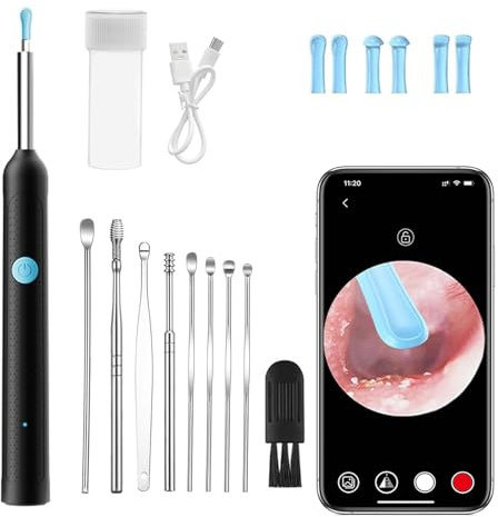 Öronvaxborttagare otoskop öronrengöring öronvax borttagare 1080P Wifi öronrengöring kamera IP67 vattentät öronspegel 3,5 mm lins, öronrengöring med 6 lysdioder för vuxna barn, iOS Android